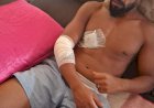 Trabalhador é atacado por pitbull durante coleta de lixo em Canarana