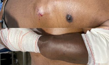 Idoso é brutalmente agredido no bairro Jardim União em Canarana; suspeito é preso em flagrante pela Polícia Militar