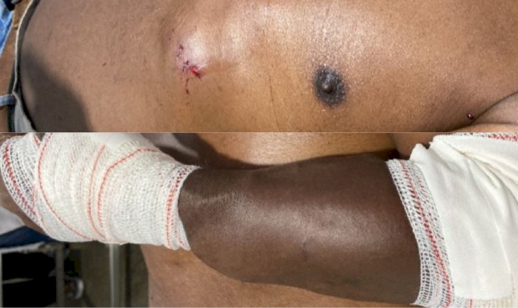 Idoso é brutalmente agredido no bairro Jardim União em Canarana; suspeito é preso em flagrante pela Polícia Militar